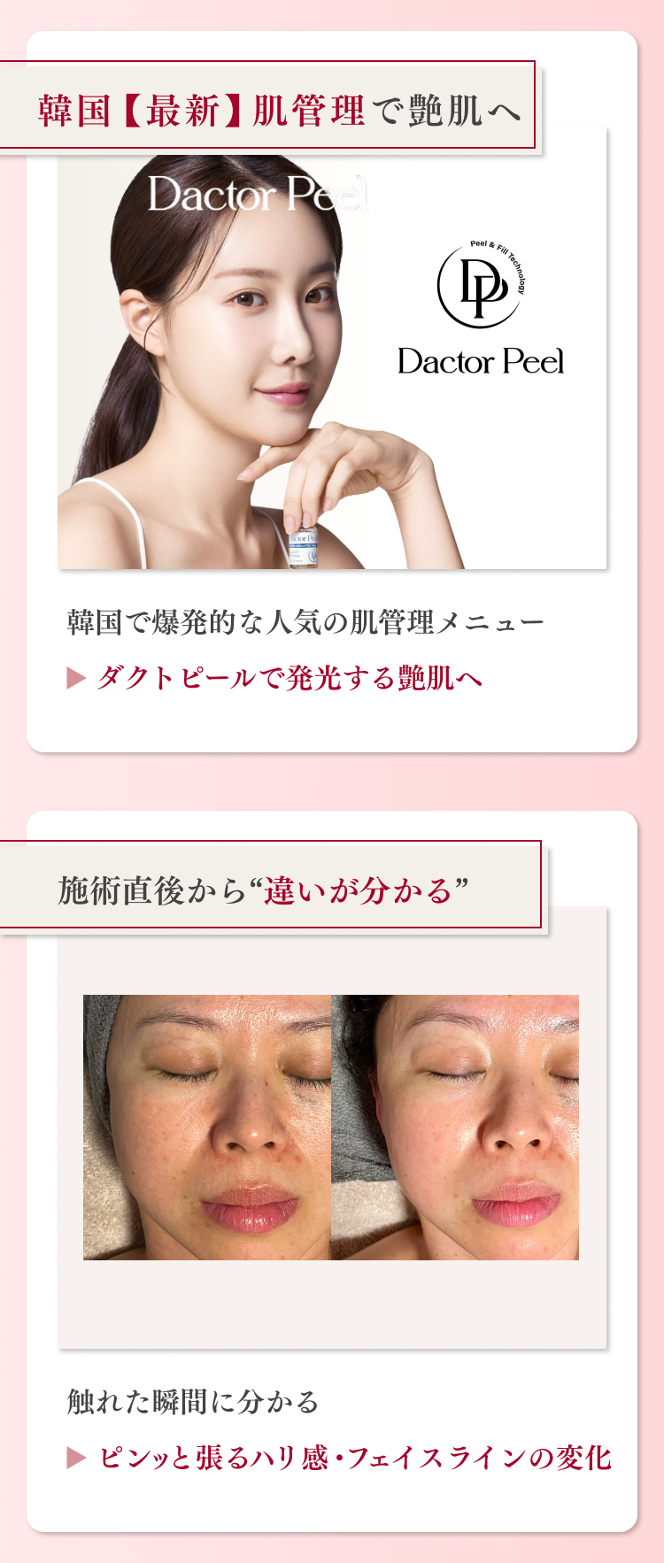 艶肌×小顔リフトの特徴