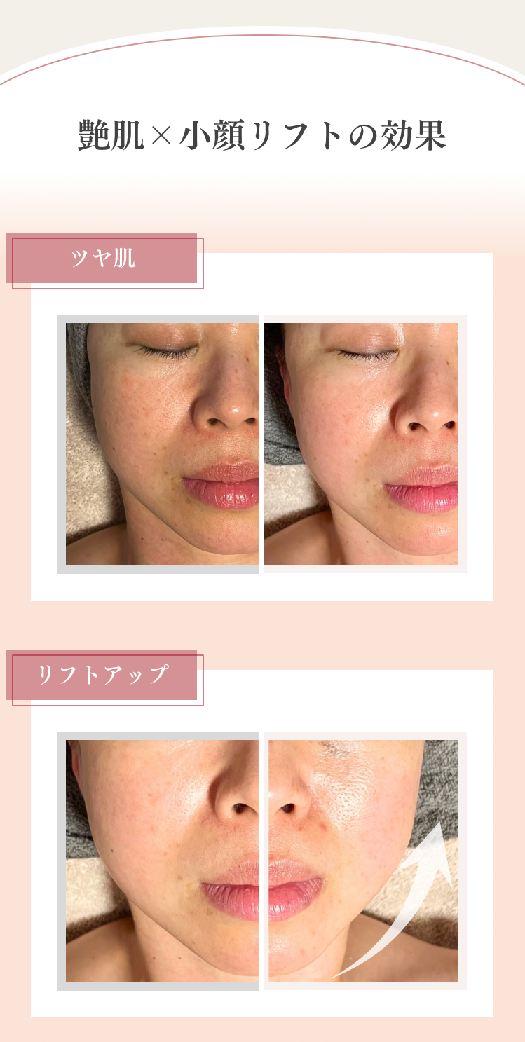 お客様ビフォーアフター