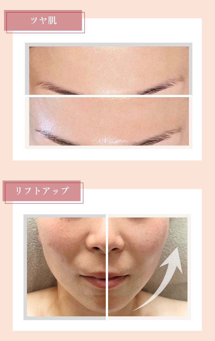 お客様ビフォーアフター