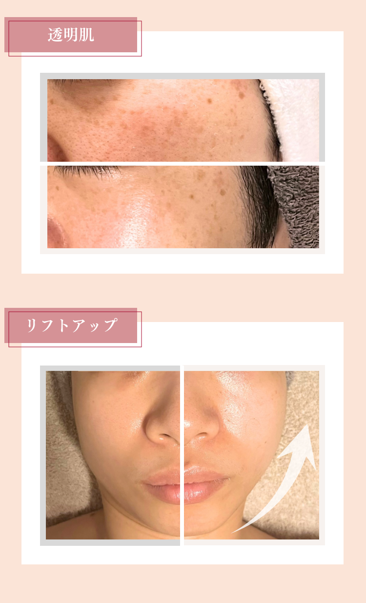 お客様ビフォーアフター